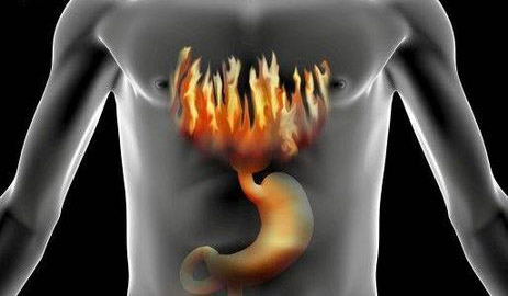 Image result for gastric problems