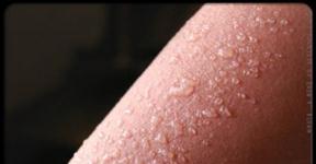 What Are The Symptoms Of Sunburn?