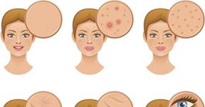 Skincare sins you may not know of