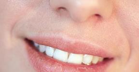 How to Avoid Chapped Lips