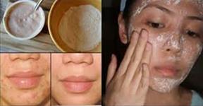 Homemade Face Mask For Scars Removal