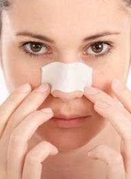 What Are Blackheads?